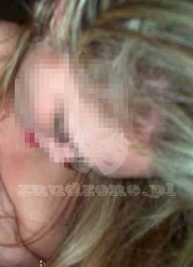 oral130181